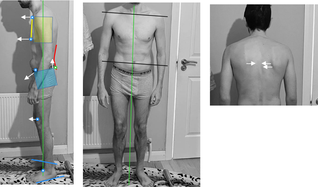 Posture assessment