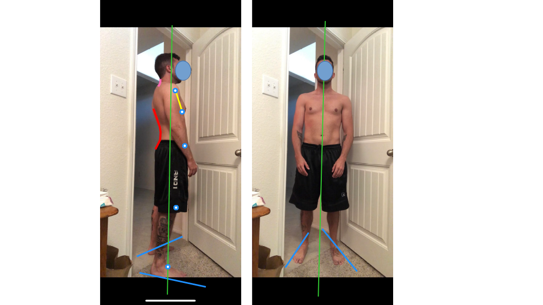 Posture assessment