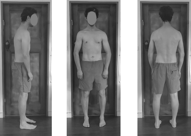 Example of good photos for posture assessment