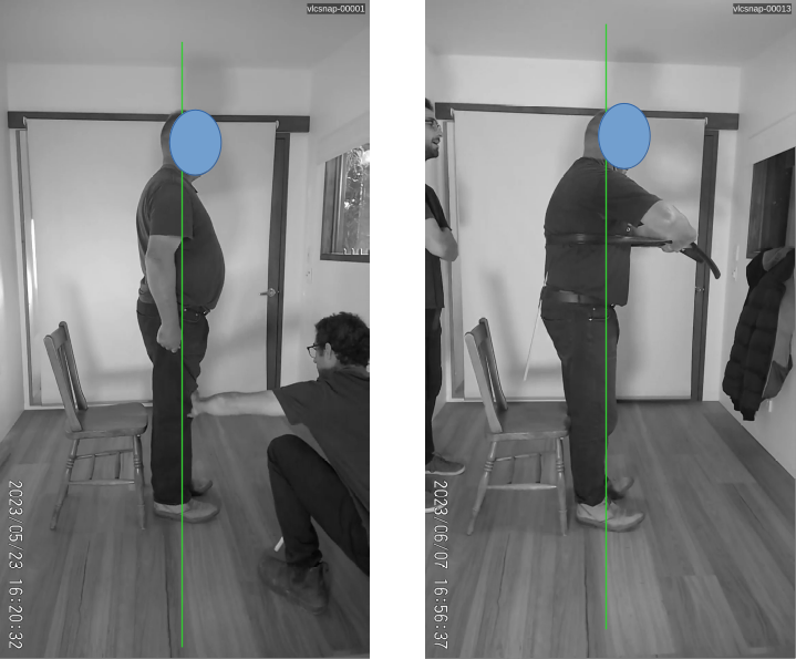 Posture assessment example