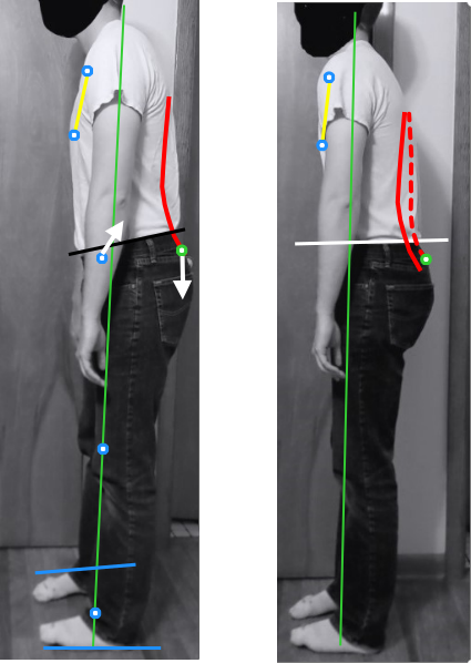 Posture assessment