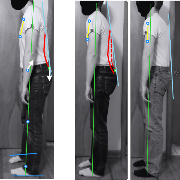 Posture assessment v3