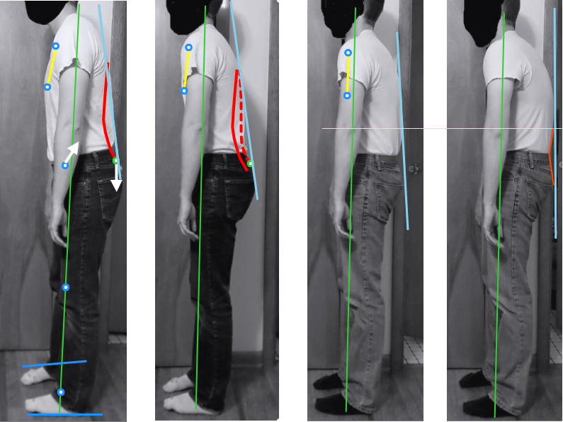 Posture assessment