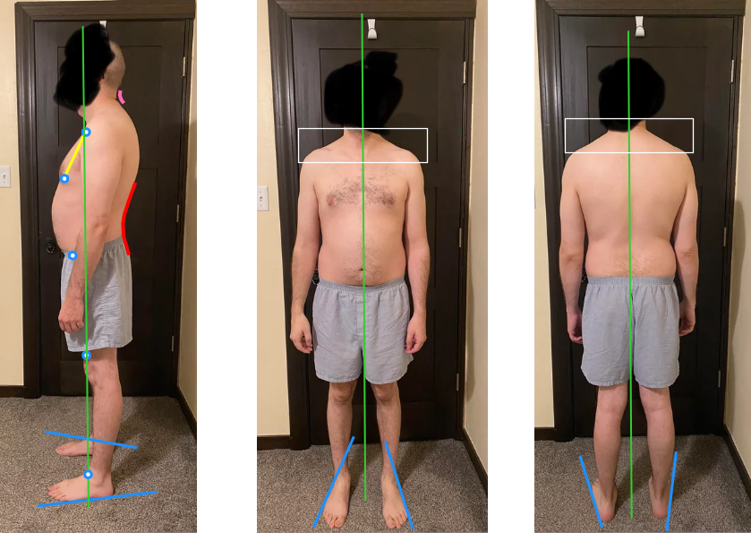 Posture assessment