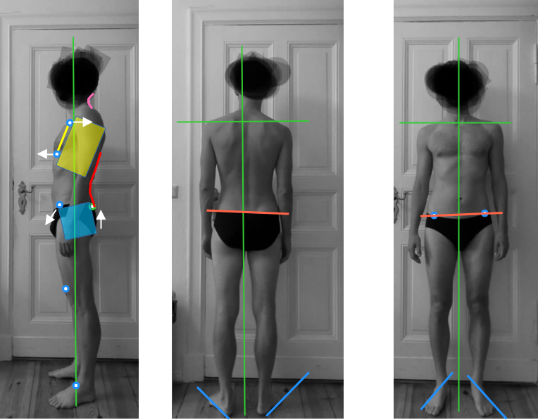 Posture assessment