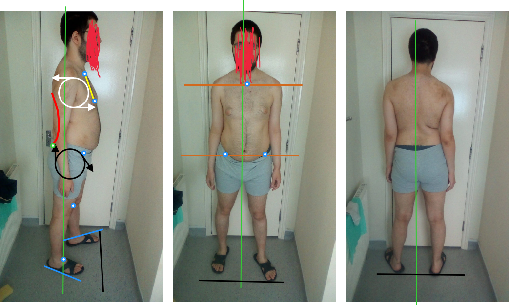 Posture assessment