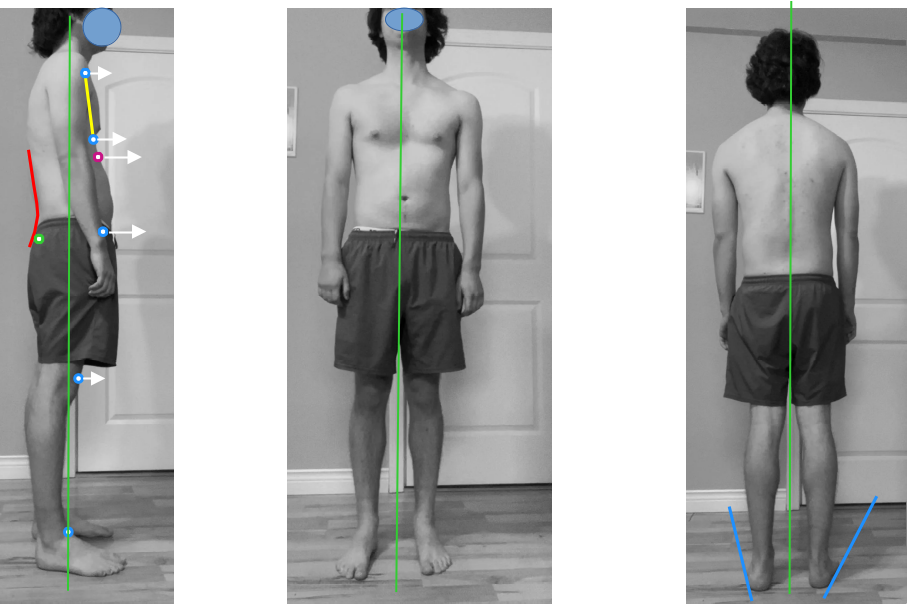 Posture assessment