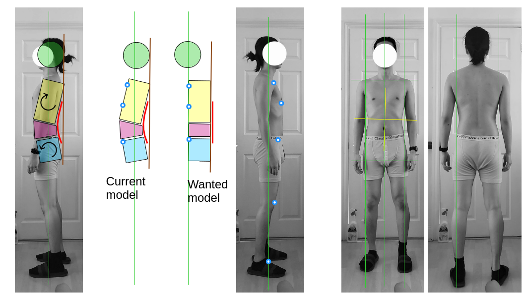 Posture assessment