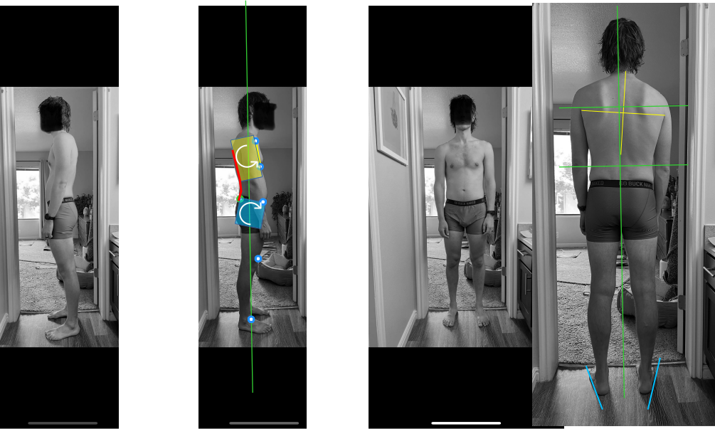 Posture assessment