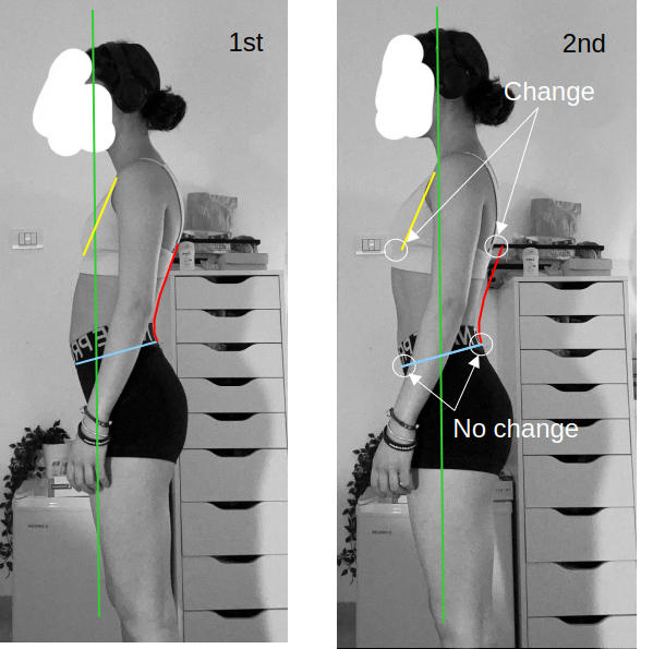 posture assessment