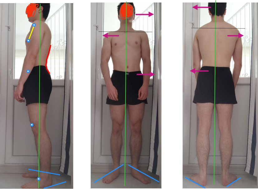 Posture assessment