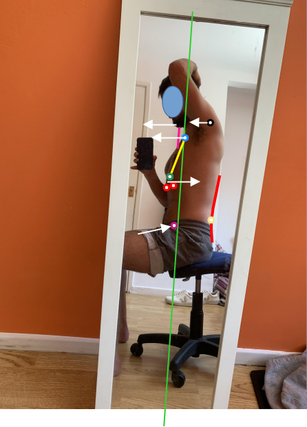 Posture assessment