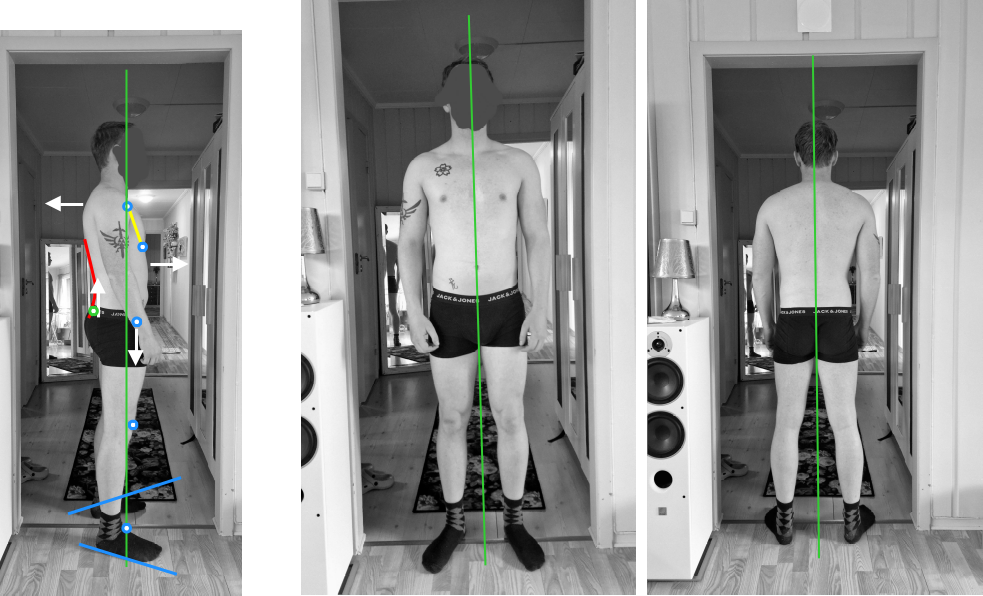 Posture assessment