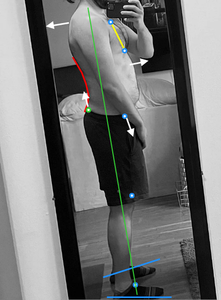 Posture assessment