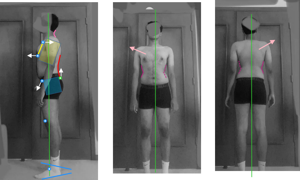 Posture assessment