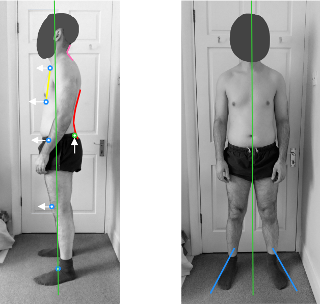 Posture assessment