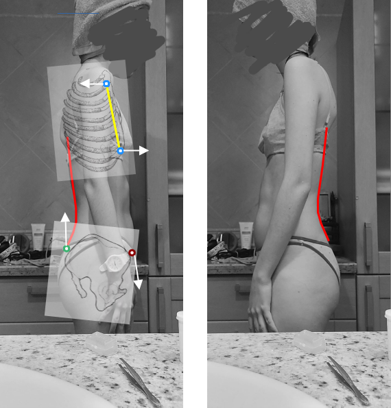 Posture assessment