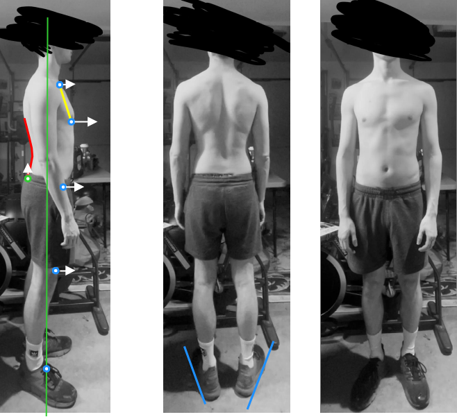 Posture assessment