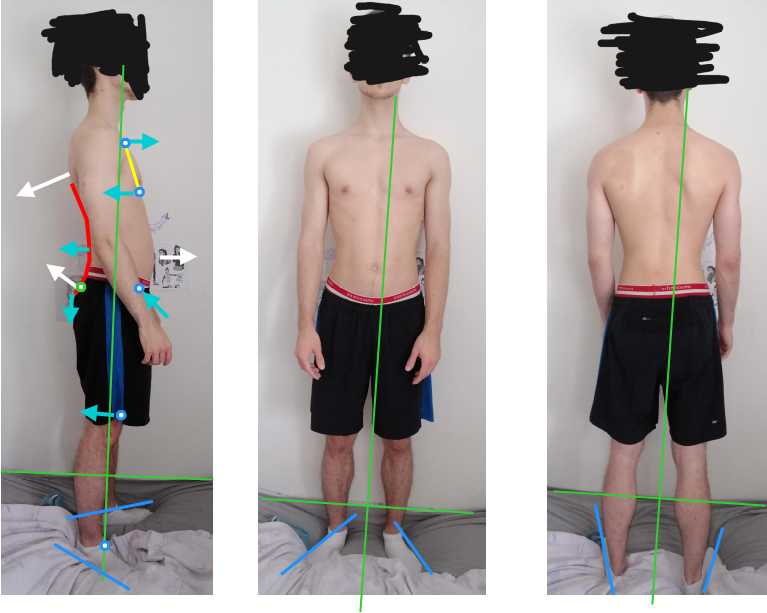 Posture assessment