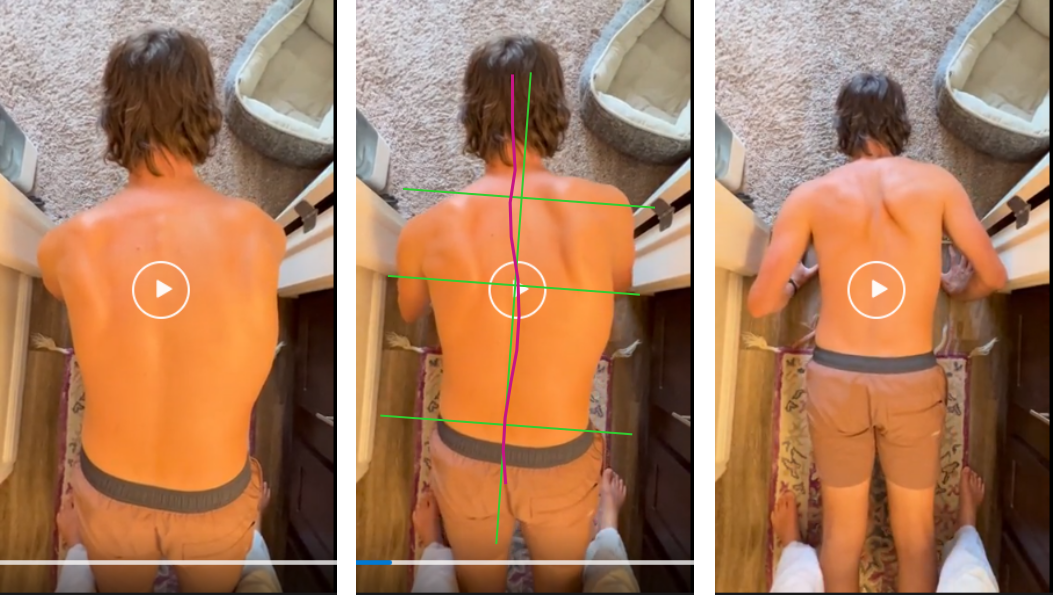 Posture assessment