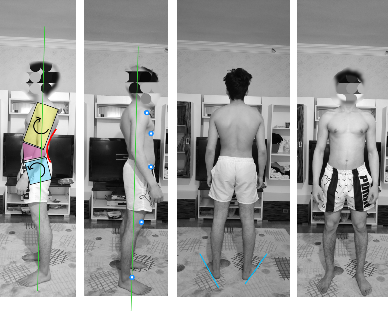 Posture assessment