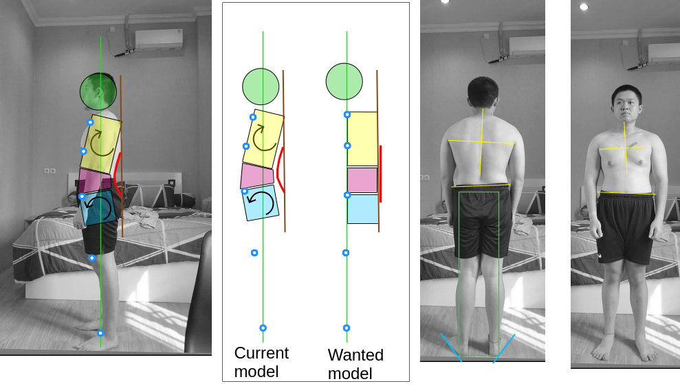 Posture assessment