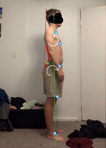 Posture assessment