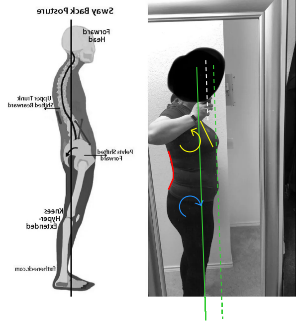 Posture assessment