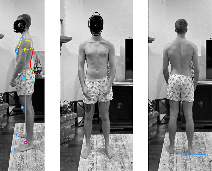 Posture assessment