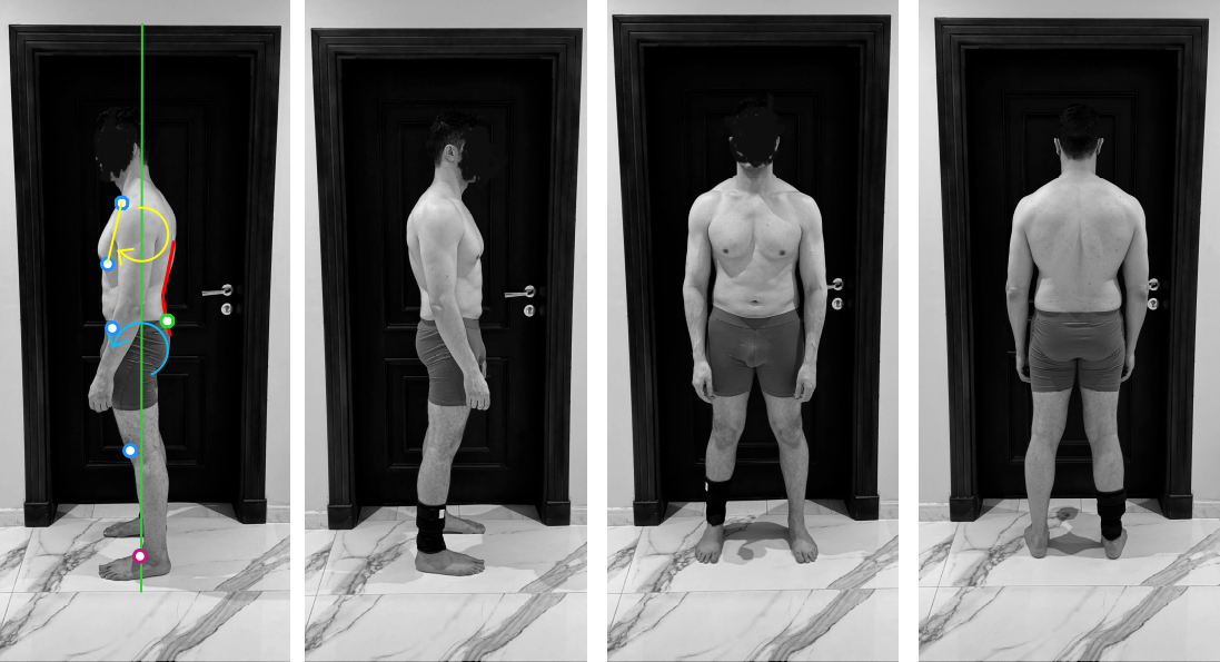 posture assessment