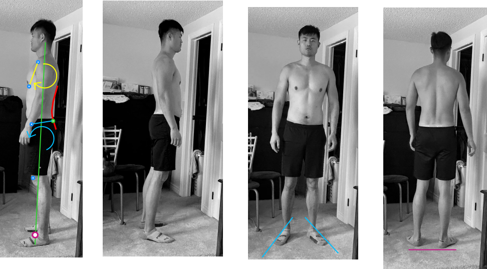 posture assessment