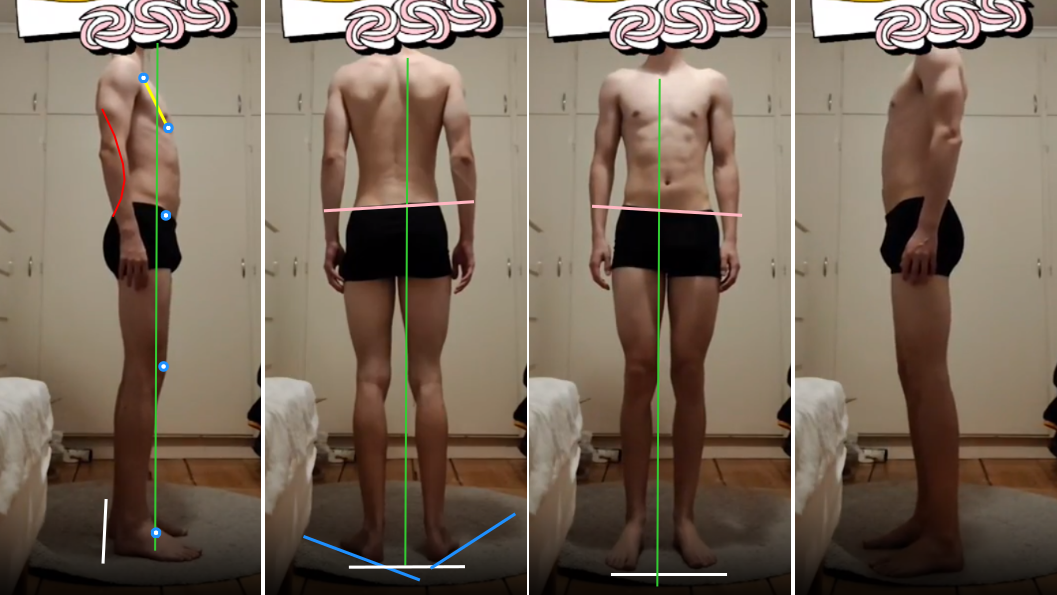 Posture assessment