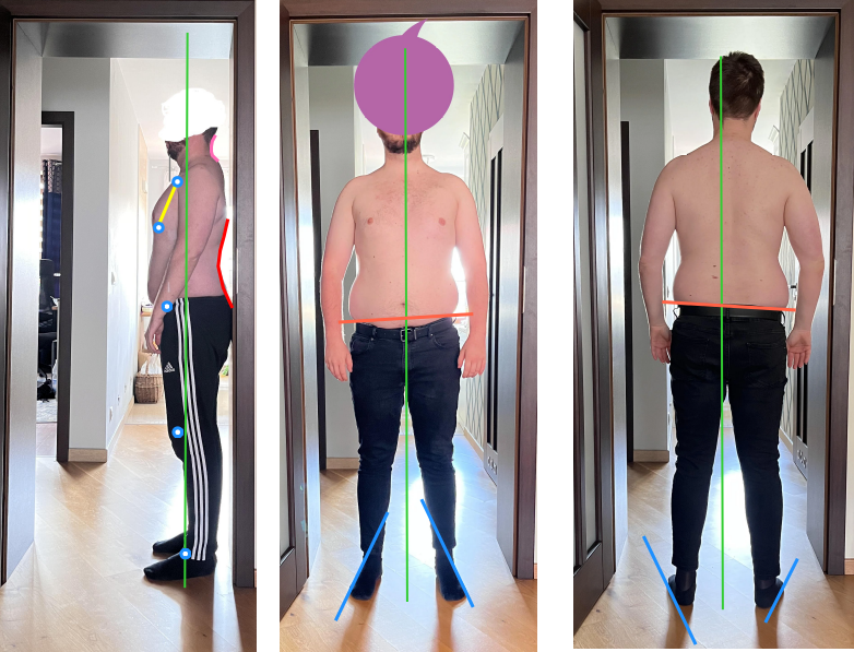 Posture assessment