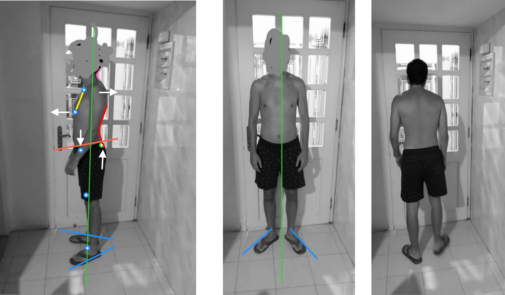 Posture assessment