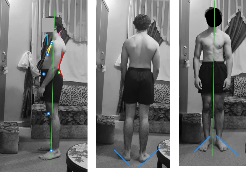 Posture assessment